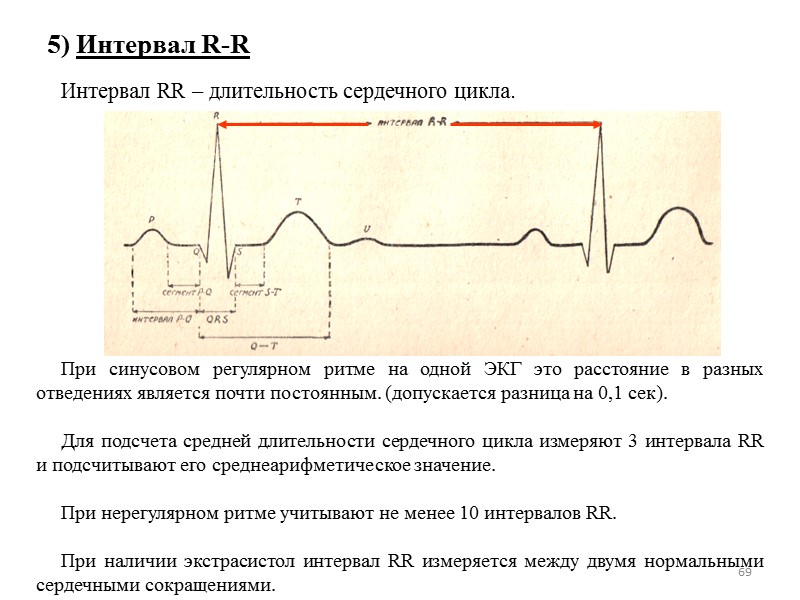 69 5) Интервал R-R      Интервал RR – длительность сердечного